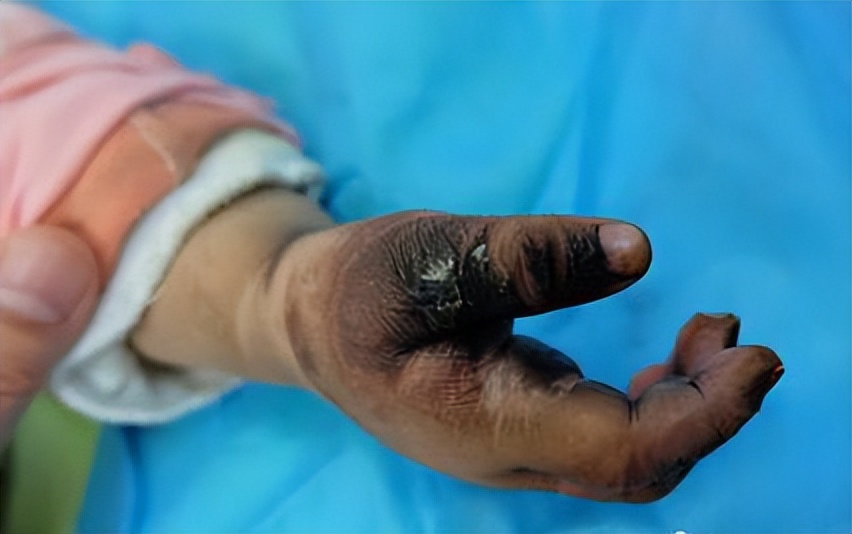 重庆小女孩筷子放入插座,四岁小女孩将手放进插座里