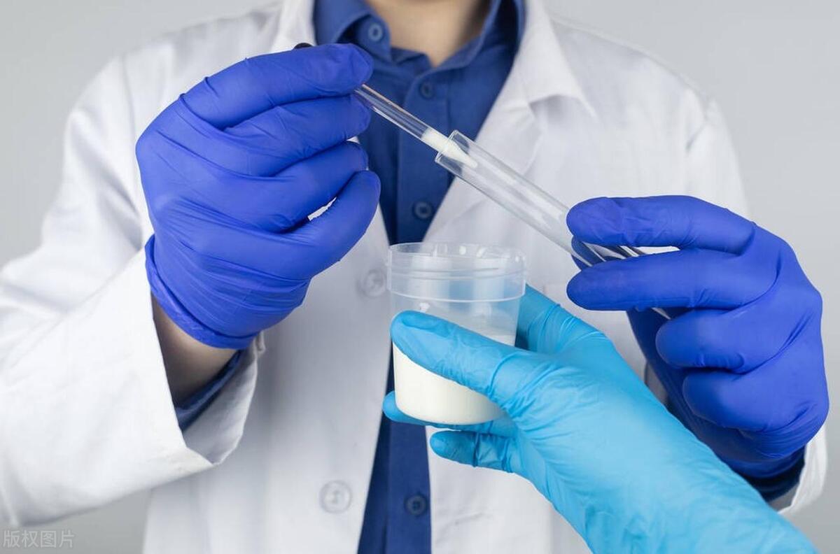 射出来的精液像水一样稀，是无精症吗？医生为你揭开谜团