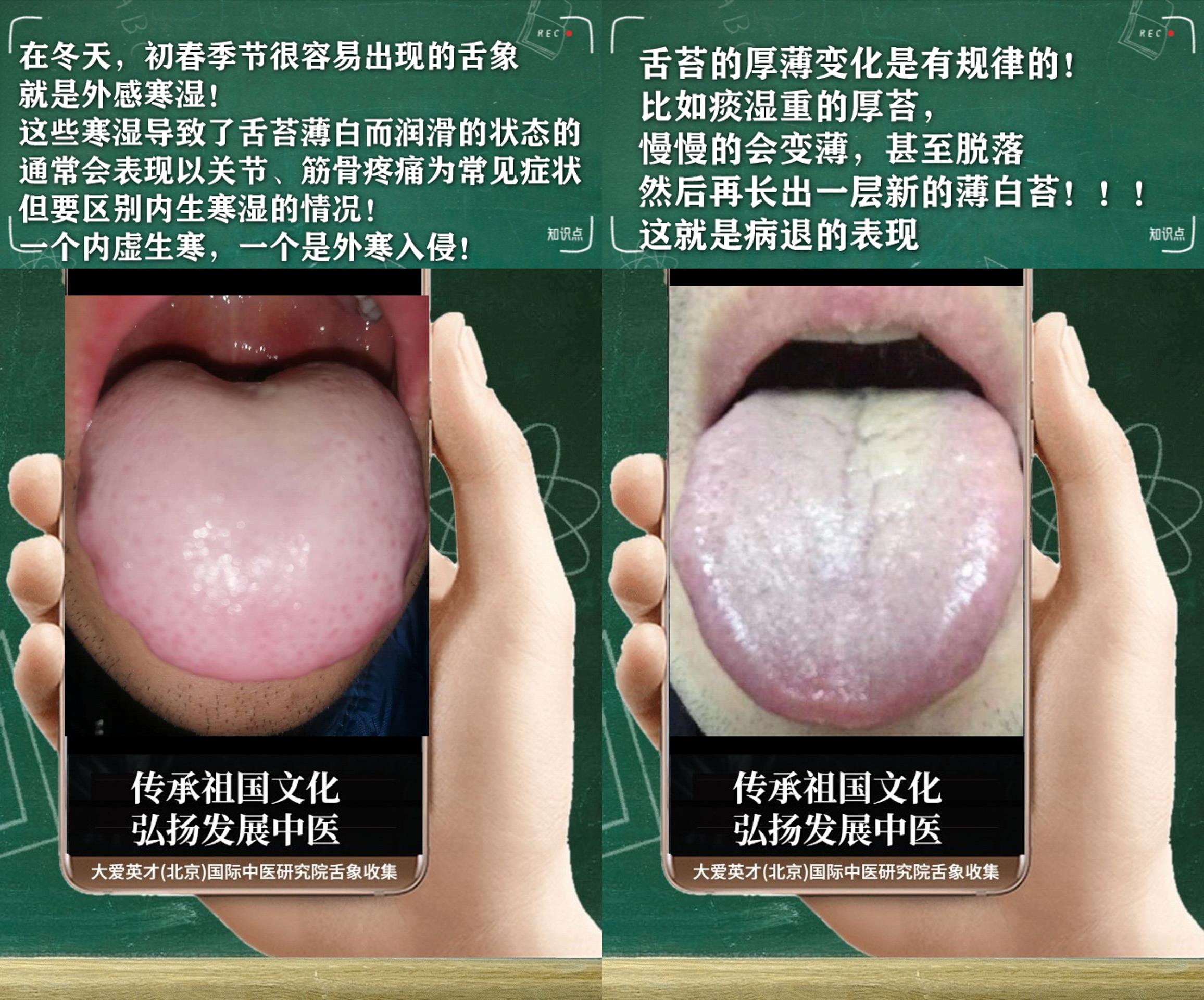 腰膝酸软中医辨证论治,中医腰膝酸软