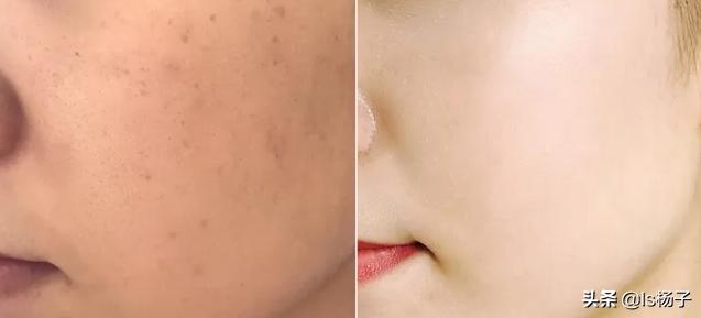 肤色变白最有效的方法,如何让又黄又暗肤色变白