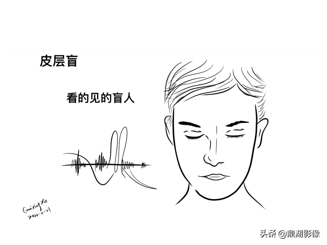 大脑皮层的解剖与定位,大脑解剖学习绘图笔记