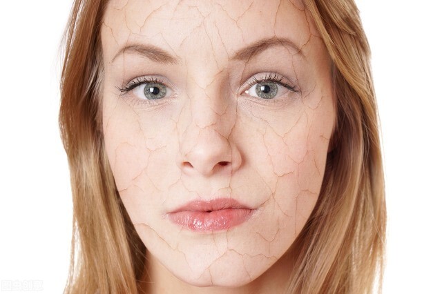 外油内干是皮肤屏障受损吗,外油内干是脂溢性皮炎吗