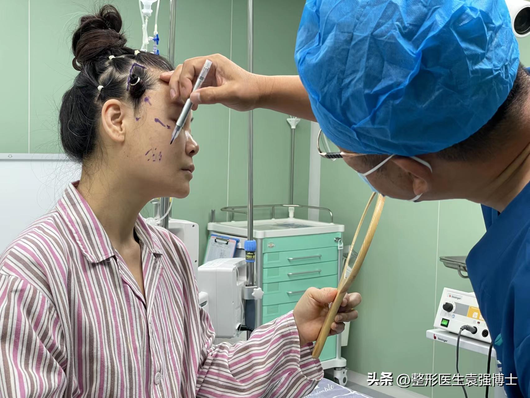 大拉皮前后效果,拉皮前后效果自然吗