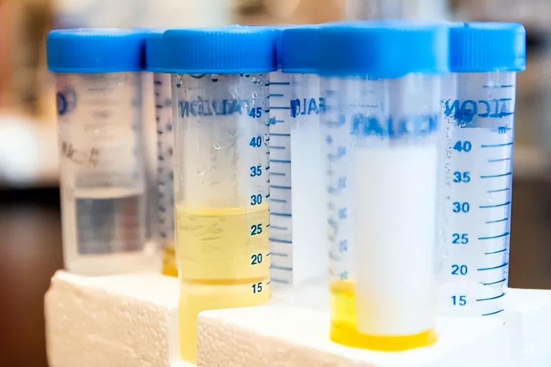 基于介孔TiO2/Ag纳米复合材料的拉曼免疫传感器研究