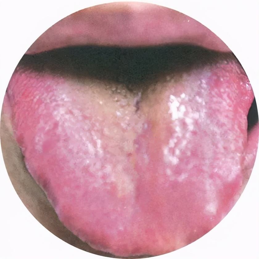 一味中药快速治痛经,子宫内膜厚导致痛经的中药