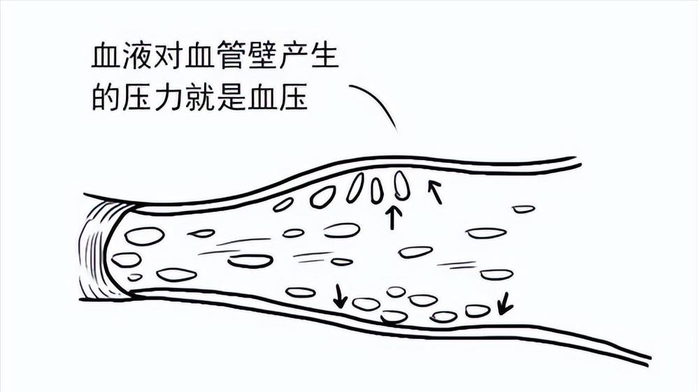 老年人舒张压多少是正常范围,老年高血压患者舒张压目标值