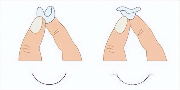 隐形眼镜戴反了一天,隐形眼镜正反面戴反了有事吗