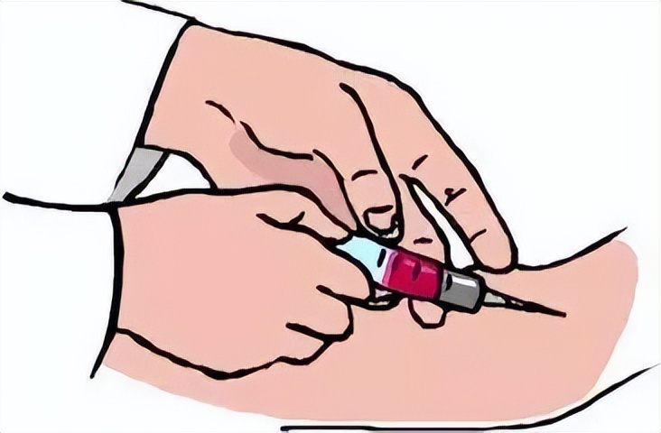 提升试管促排效果，做好这7件事情