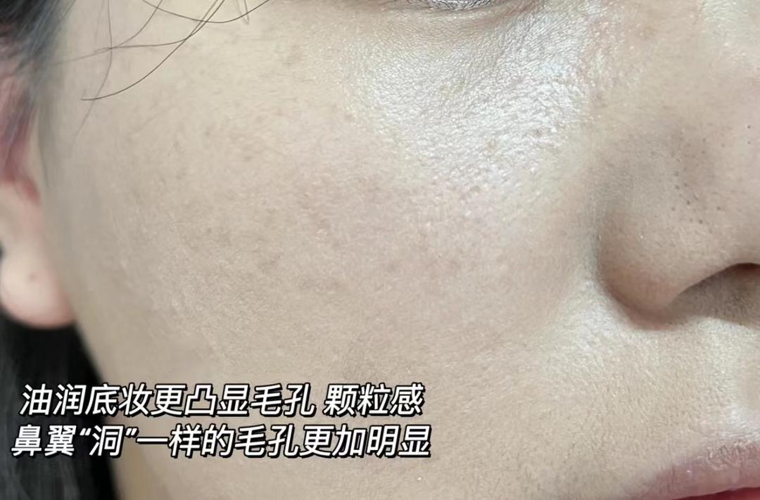 缩毛孔最简单方法,缩毛孔的方法亲身经历