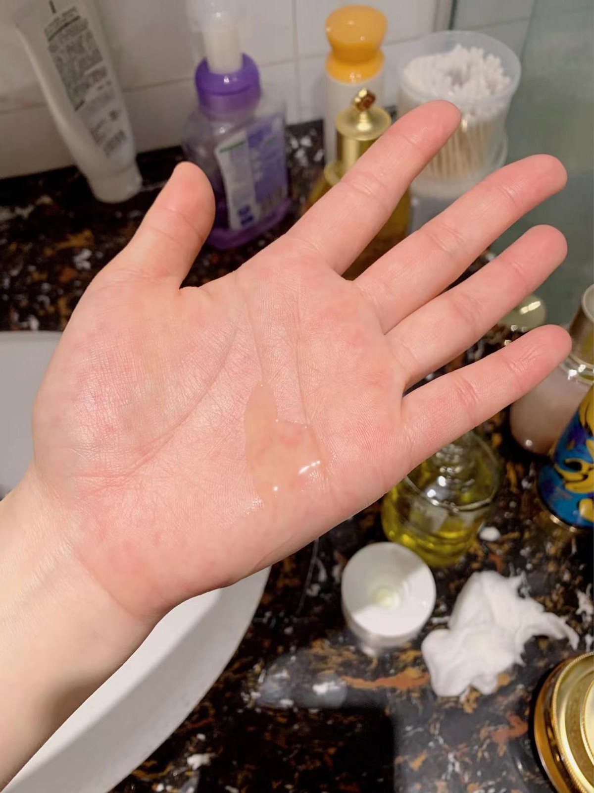 袋鼠妈妈的妊娠油怎么样？袋鼠妈妈妊娠油的实际体验效果分享