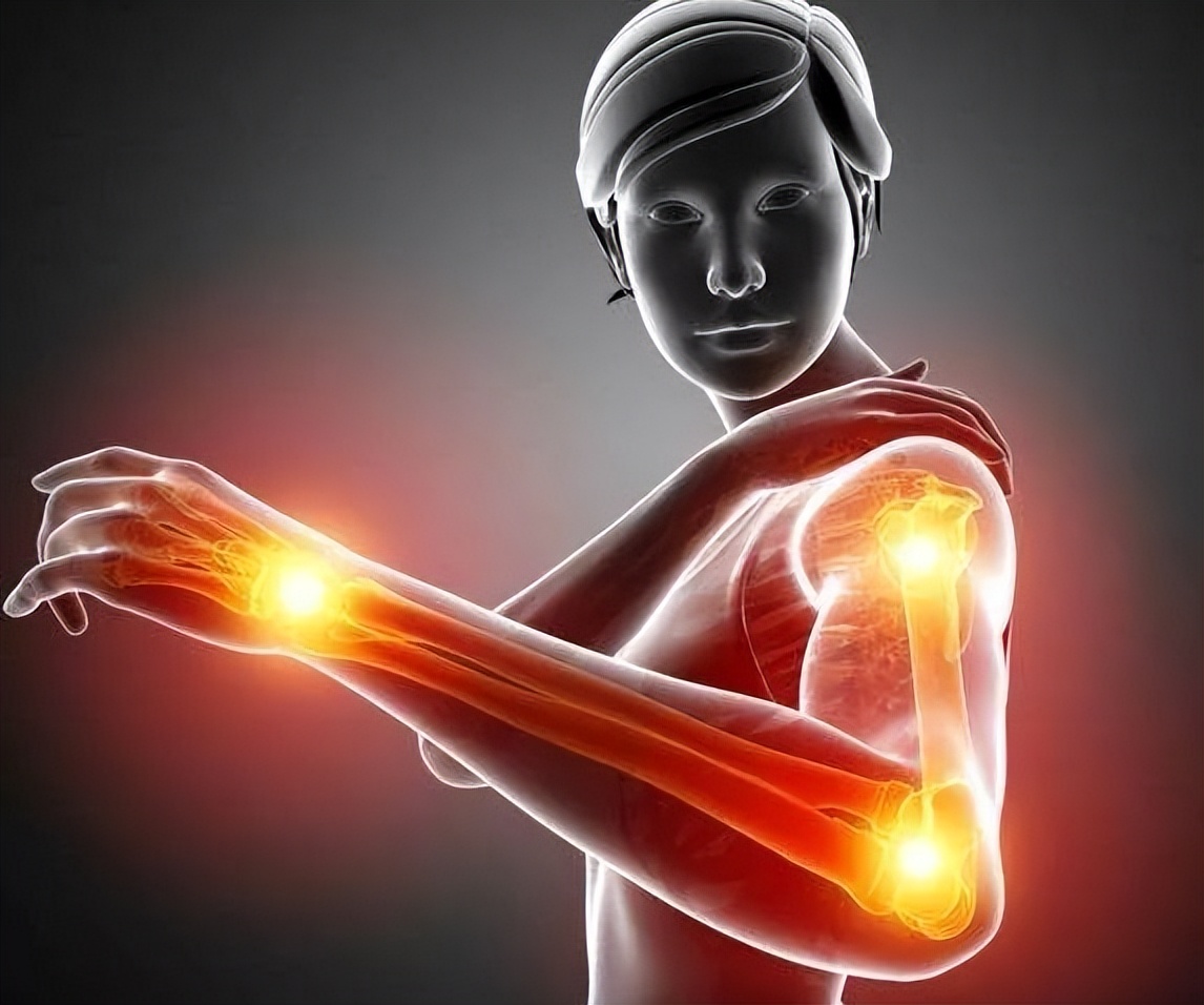 风湿痹阻辨证分析,风湿热痹的中医辨证分析