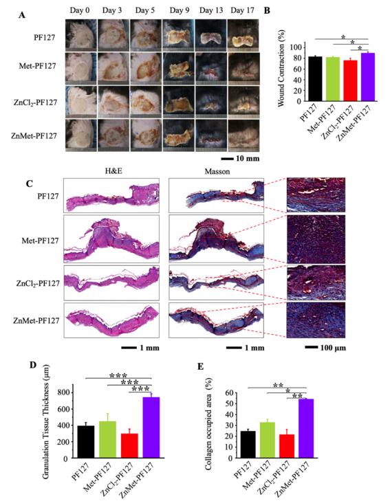 「科研快报」可喷雾热敏水凝胶与锌修饰二甲双胍促进皮肤创面愈合