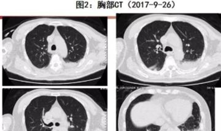 2023年12月11日2点11分,2023年12月11日11点43分