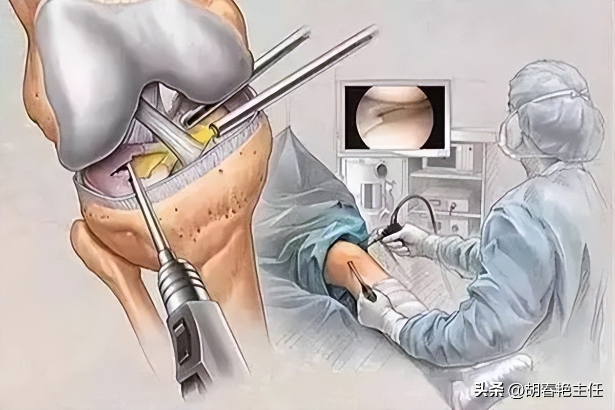 类风湿不治疗不痛了是怎么回事,类风湿骨破坏机制