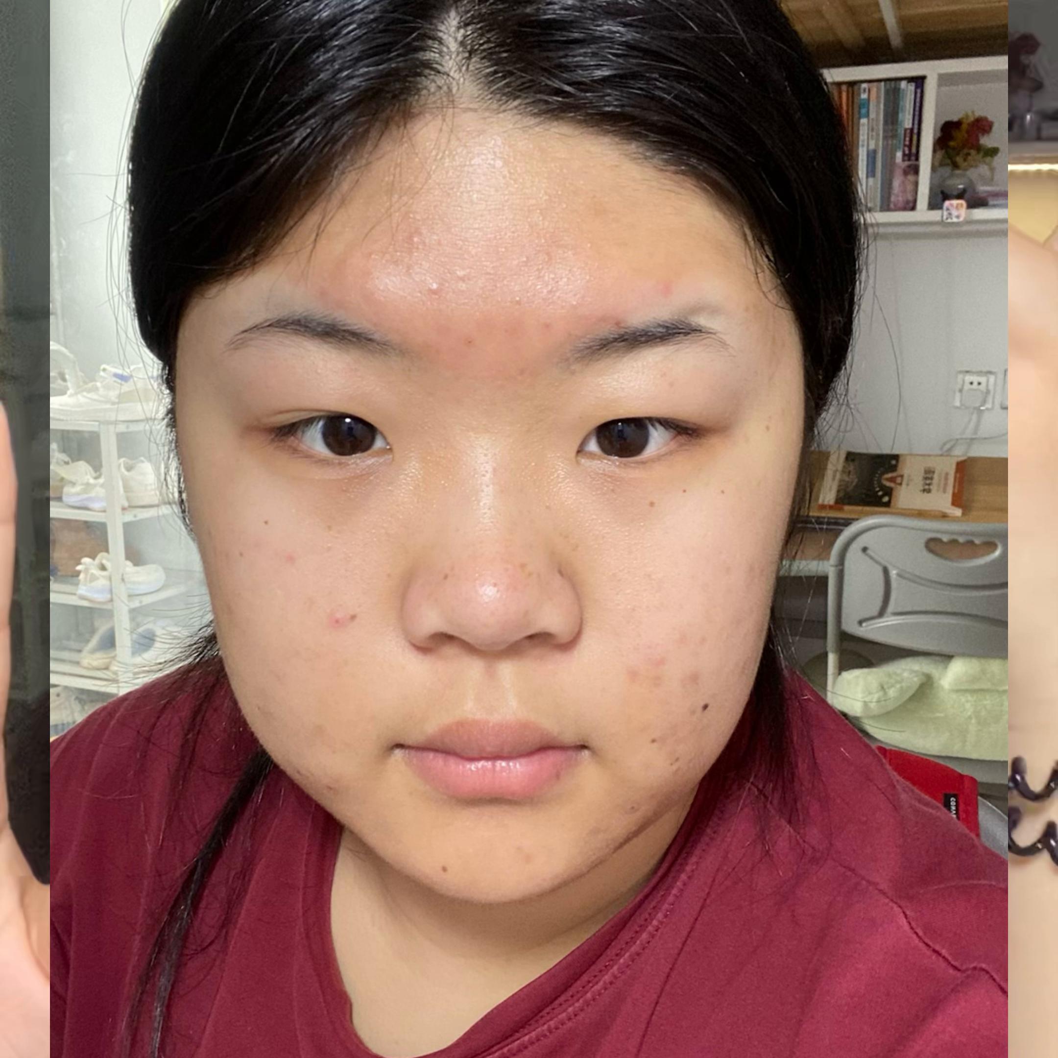 如果再见再也不红脸那真的是泰酷辣!#薇诺娜特护精华