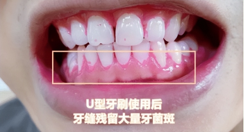 电动儿童牙刷测评前十,儿童电动牙刷测评榜第一名