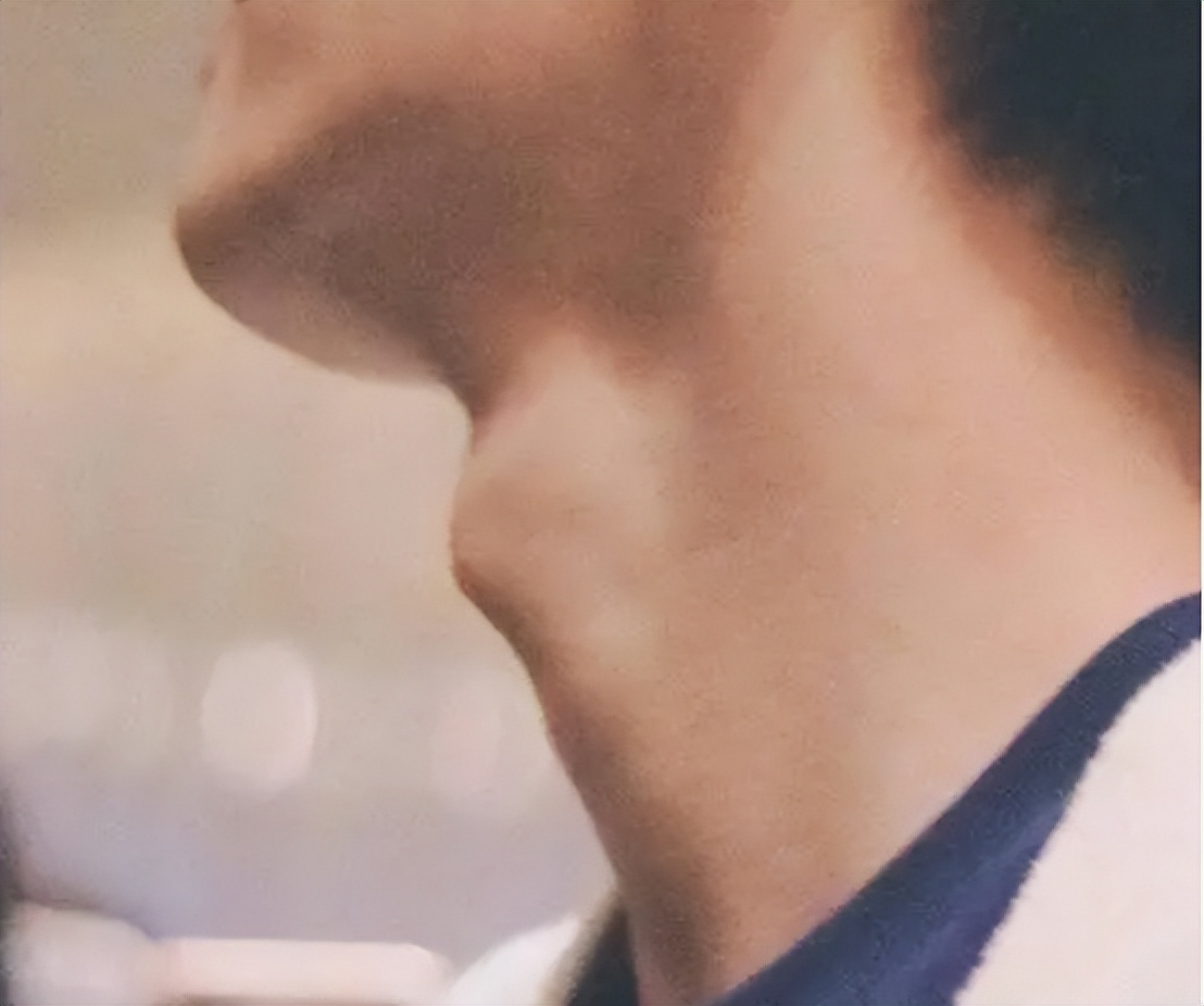 女子体内存在男女器官10年不敢回家，哪些原因导致？能治愈吗？