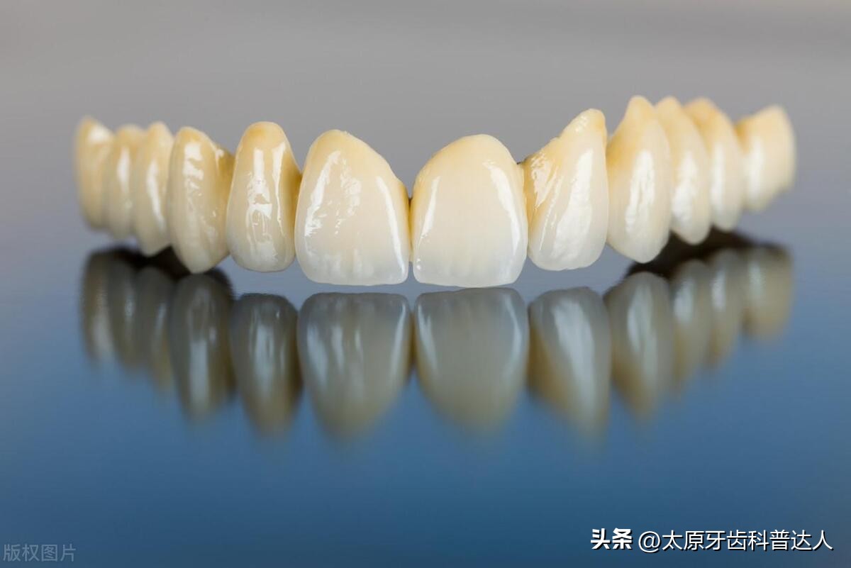 做烤瓷牙磨牙第一天注意什么,安装了两个烤瓷牙需要注意什么