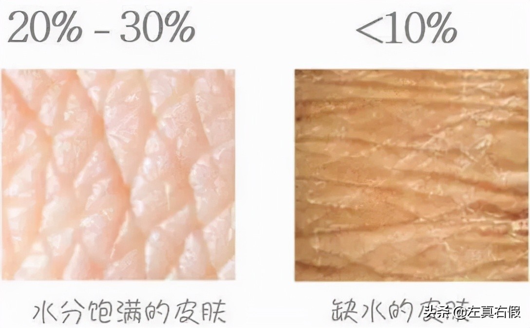 biooil百洛油测评,bio百洛油好用吗