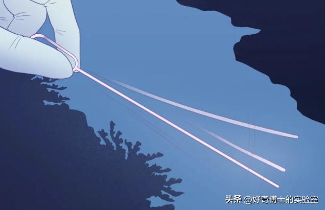 早期人流对子宫的伤害是可逆的吗,人流对女人身体有损伤吗