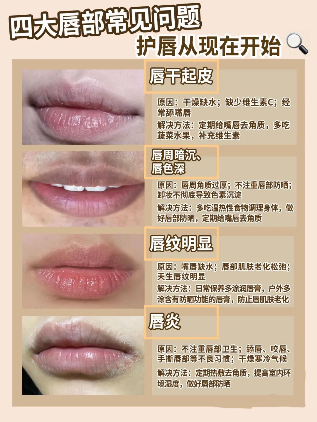 唇部问题讲解,唇部问题一招搞定