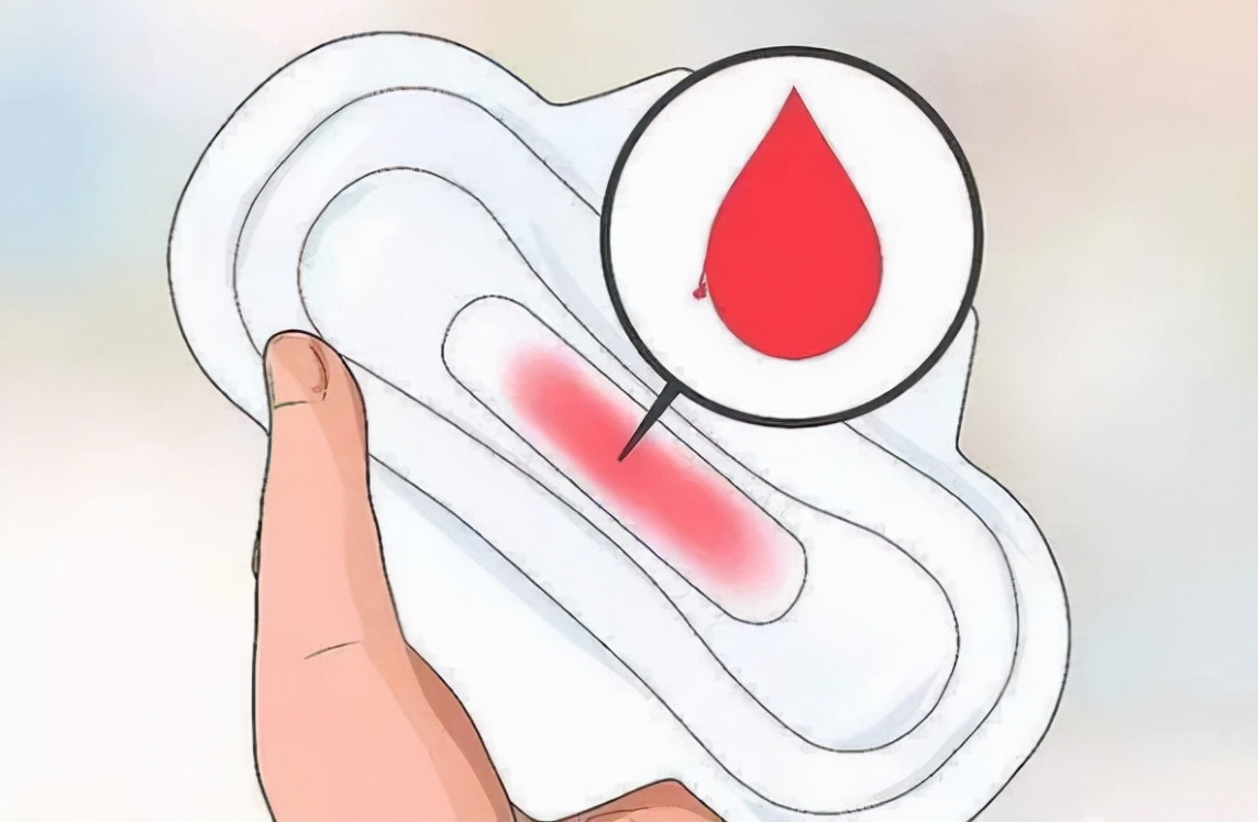 妇科流褐色的分泌物是怎么回事,为什么月经结束后有分泌物