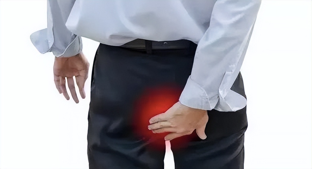 肛门附近的癌症症状,体内有癌大便先知