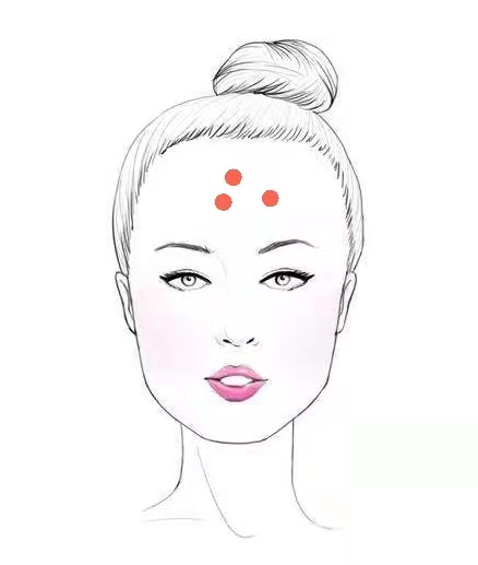 女人脸上有痘痘是什么原因造成的,脸上出痘痘的位置图解