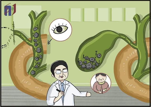 胆囊息肉手术后腹痛什么原因,胆囊结石切除手术后腹痛