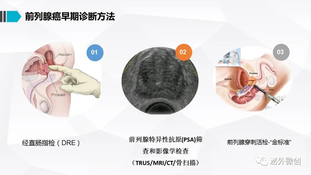 前列腺穿刺活检前用什么抗生素,南昌大学第二附属医院泌尿科