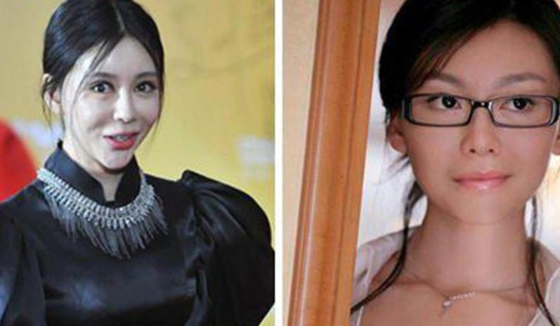 整容和不整容十年后的区别,整容与不整容的区别