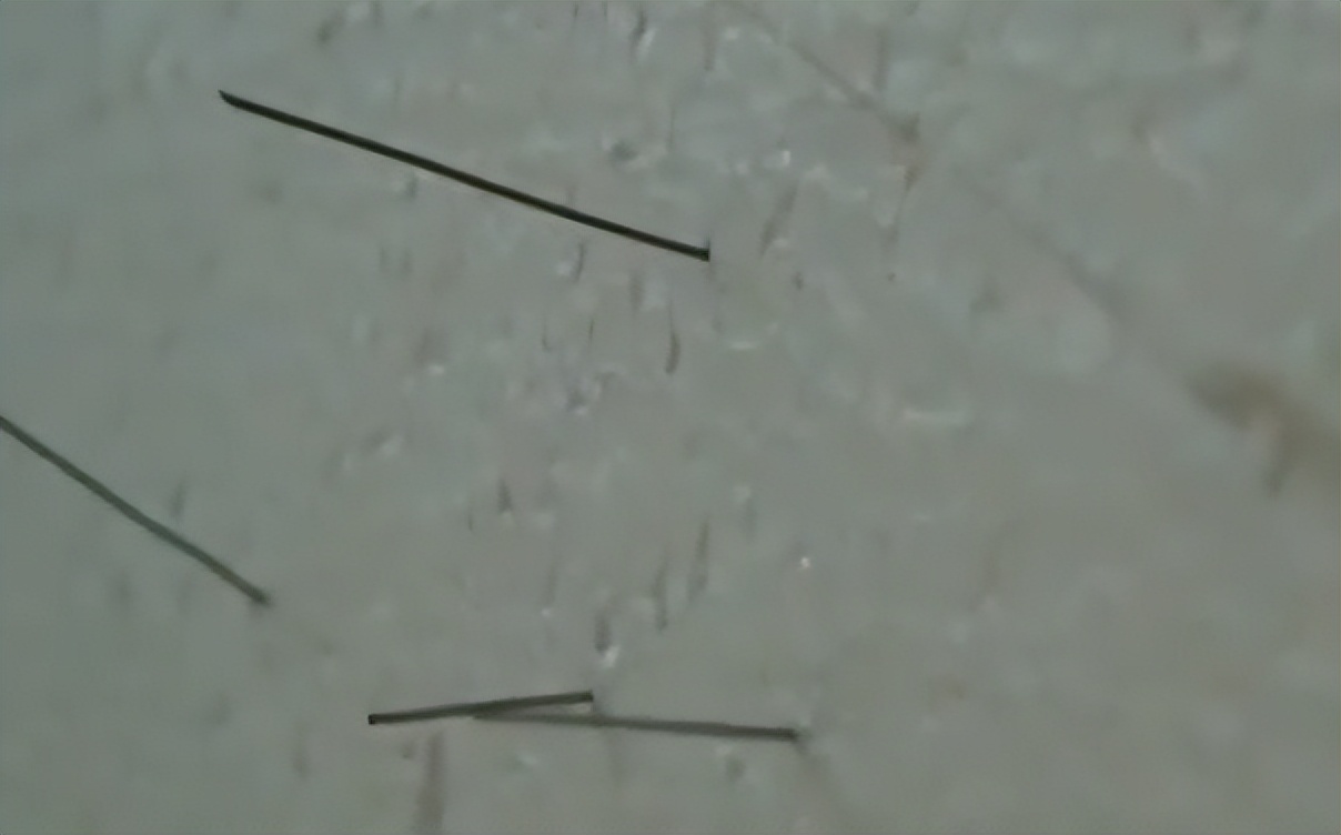 17岁男孩头痛被送进医院，医生一看X光片直接傻眼：没救了