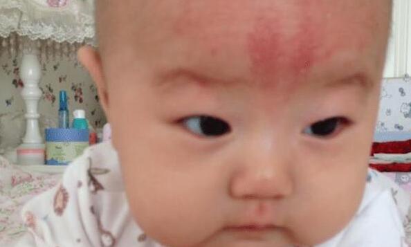 宝宝掉下床不能乱抱，妈妈该怎么办？