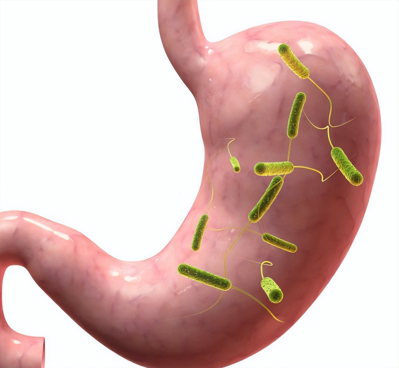 买牙膏时2种牙膏不建议购买,买牙膏含氟的好还是不含氟的好