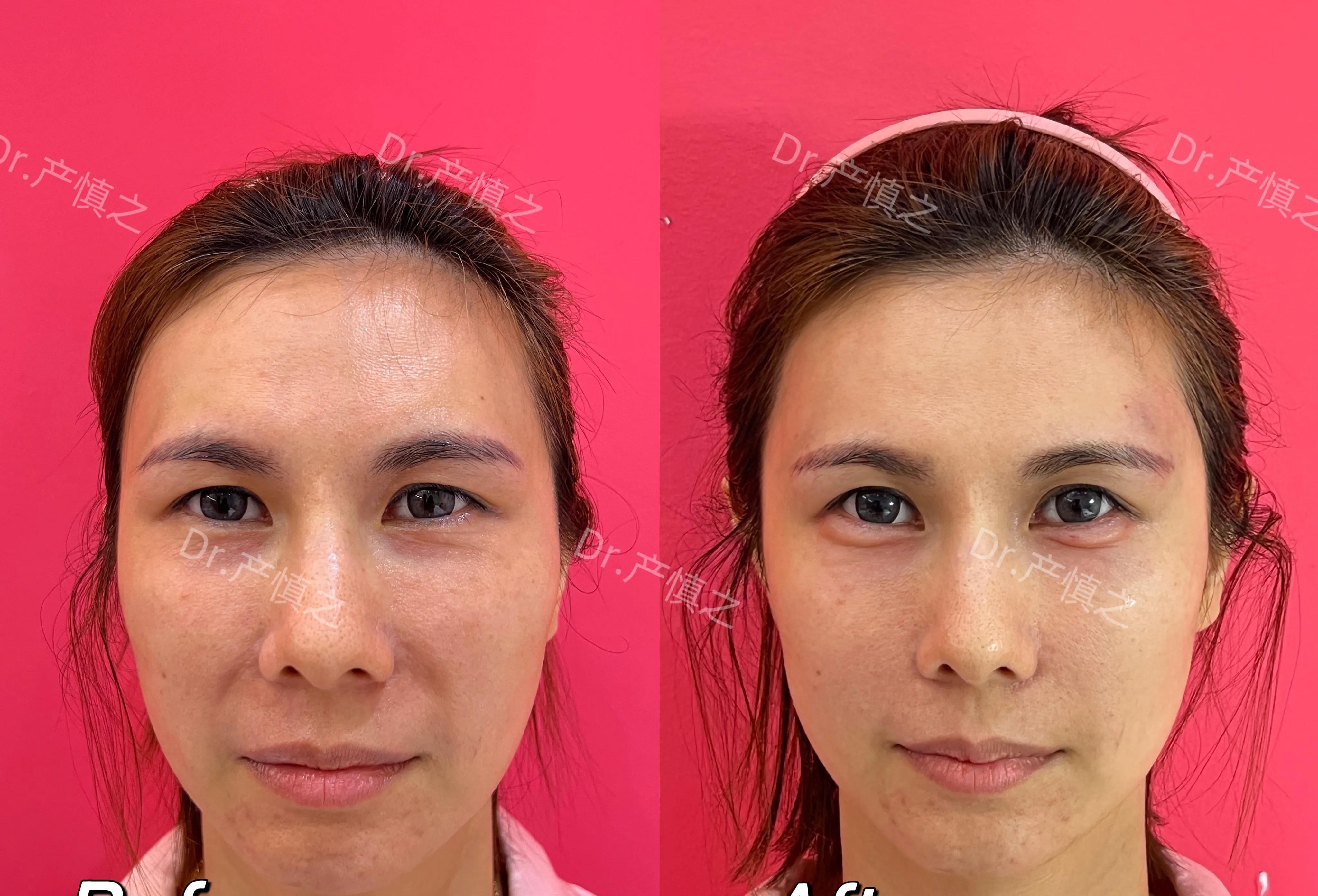 女明星集体回春做了什么医美,女明星集体回春