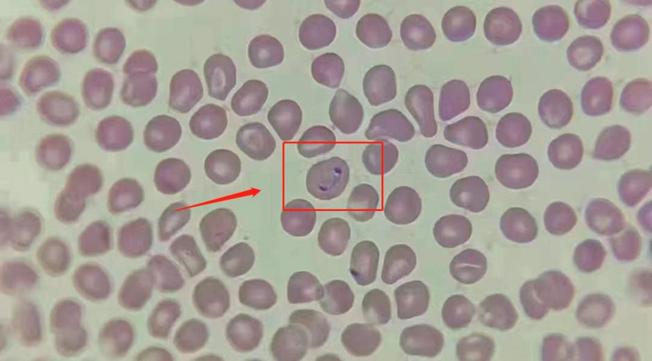 寄生虫感染严重的狗狗,狗狗巴贝斯虫生病了临死的征兆