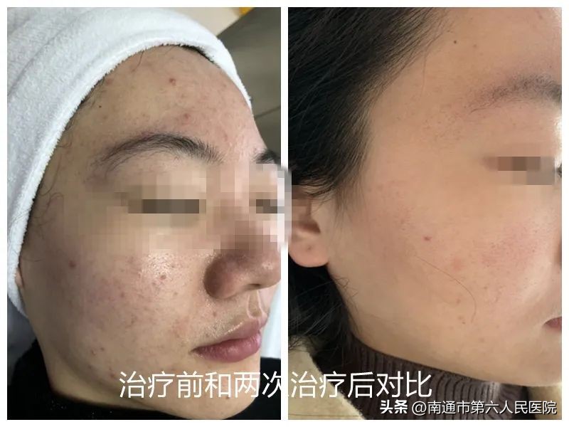 南通六院皮肤美容,南通附属医院皮肤美容科