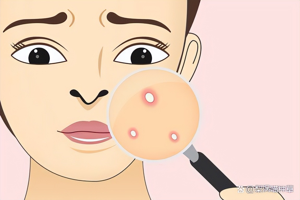 厦门混油皮控油补水护肤品推荐,油皮混油皮看过来