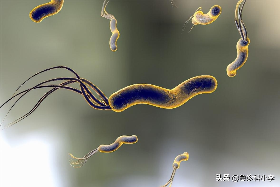 幽门螺杆菌导致的胃癌如何治疗,幽门螺杆菌根除了还会得胃癌吗