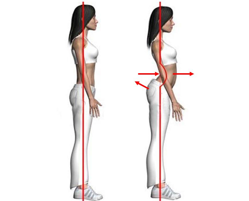 为什么体态比颜值重要,常见的9大不良体态问题