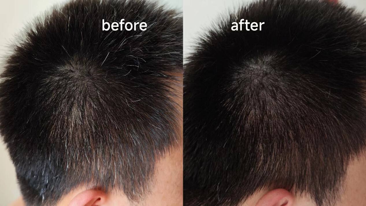 去头皮屑防掉发的洗发水推荐,脱发痒用哪一款洗发水比较好