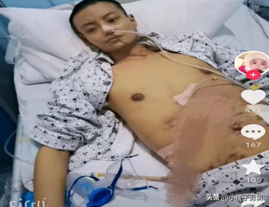 四川被捅小伙花200万治疗,四川被捅小伙确认去世后续