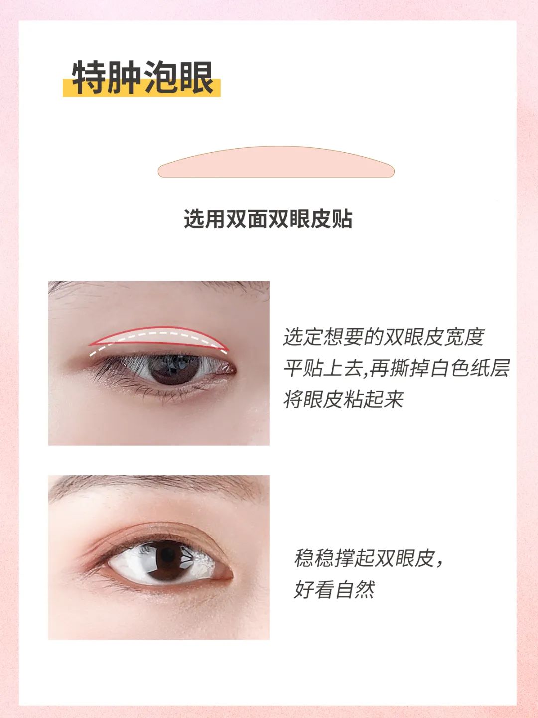 不同眼型的双眼皮贴贴法,各种眼型的双眼皮贴法详细教程
