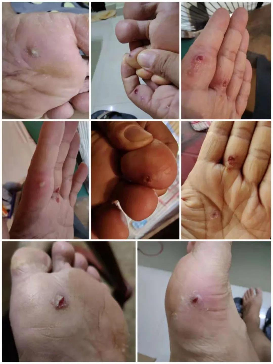 集中营六记,集中营逃亡7年