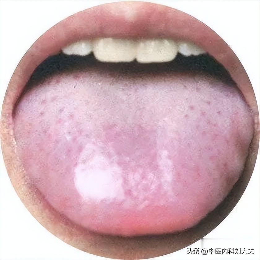 脾胃虚寒腹胀食欲不振要调理多久,脾胃虚弱腹部胀满怎么食疗