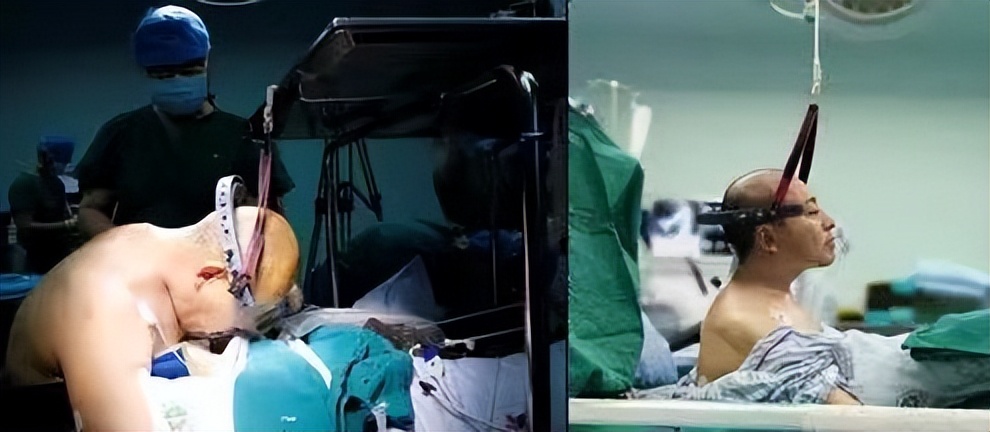 鎶樺彔浜烘潕鍗庤鏁叉柇鍚庨噸濉戠殑浜虹敓,鎵撳叆22鏍归挗閽夌殑鏉庡崕濡備粖鎬庢牱