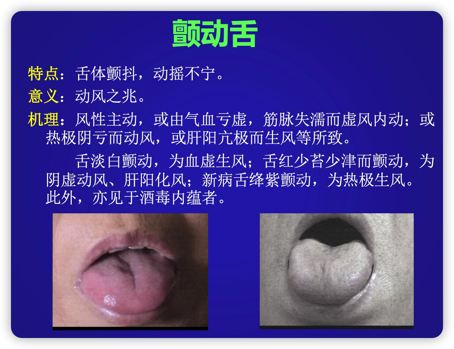 舌诊不难:解读颤动舌、吐弄舌和短缩舌