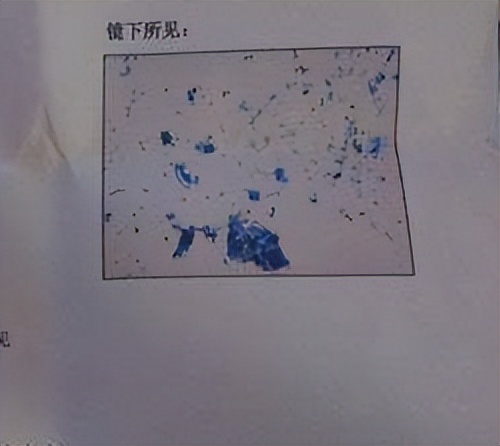 六旬男医生，趁体检猥亵患者，舔女病人*处私**，事后只被拘留5日