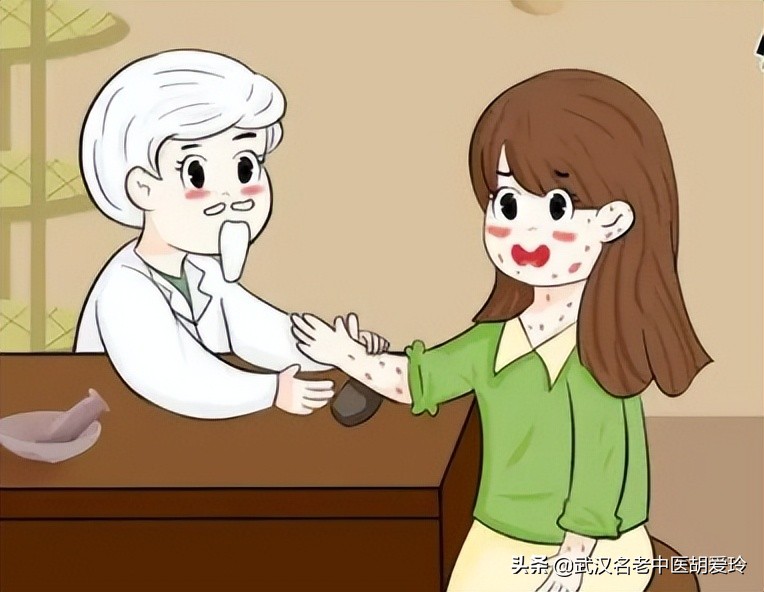 头上牛皮癣特别痒怎么办,头上有牛皮癣怎么解决