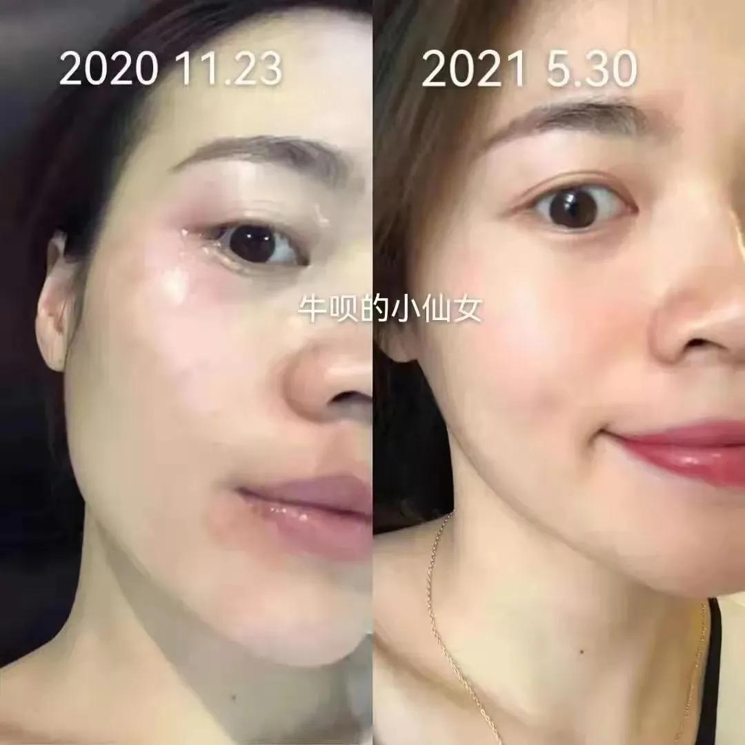 董欣护肤品哪个好用,董欣护肤品推荐